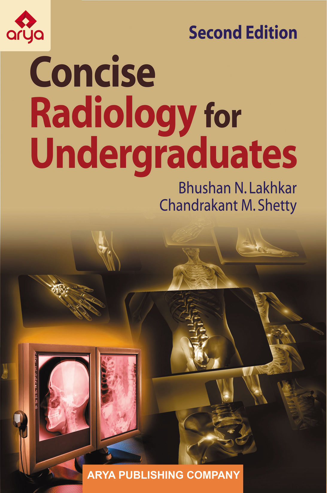 Concise Radiology for Undergraduates 